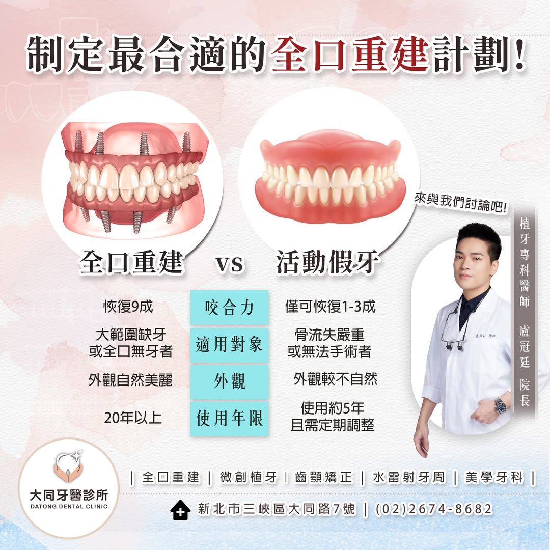 全口重建 vs 活動假牙？