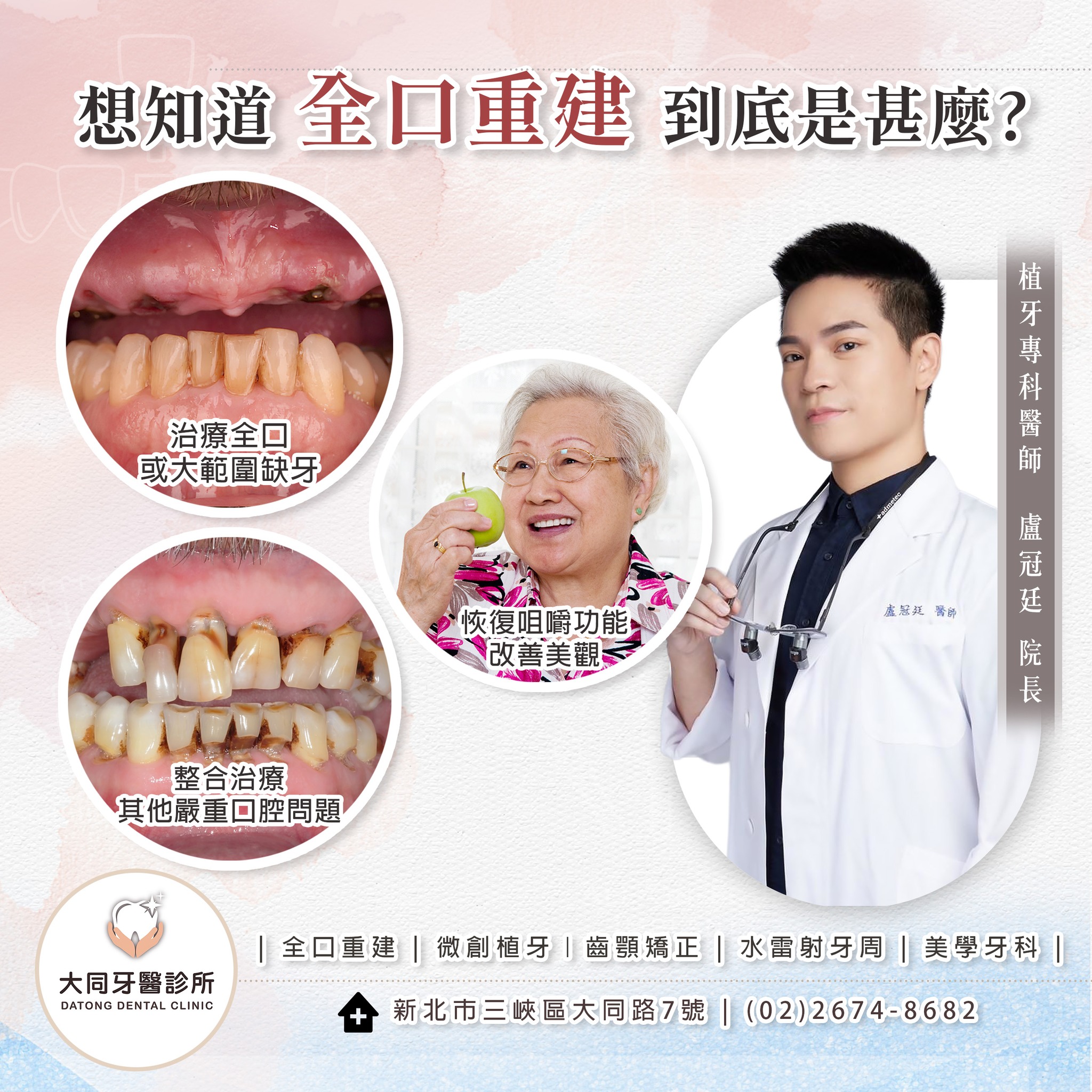 您或許聽過全口重建，但它的原理與效果您知道嗎？