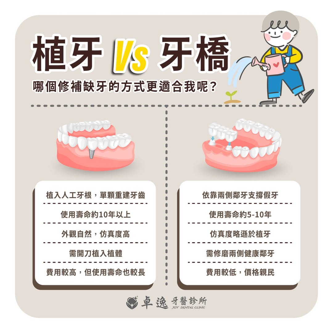 缺牙不是小事，植牙還是牙橋？