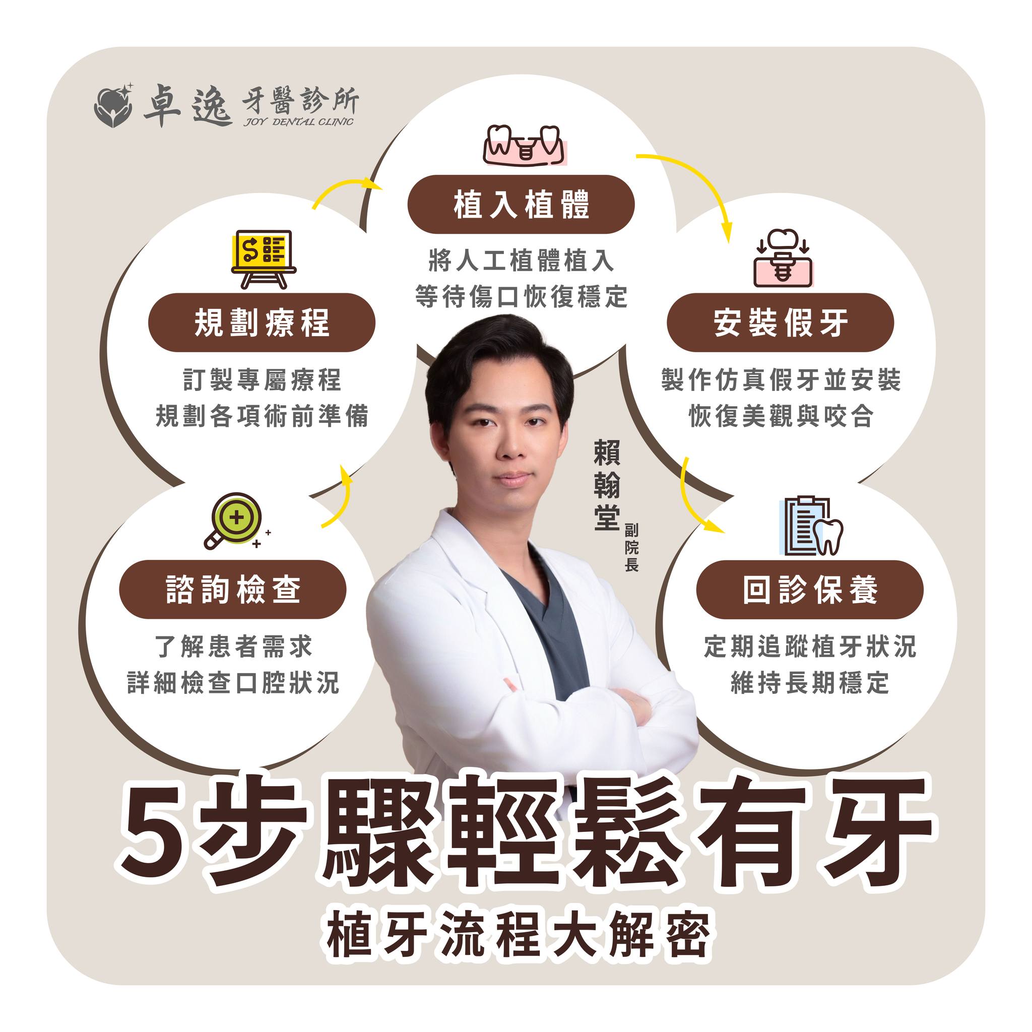 5步驟帶你了解植牙流程