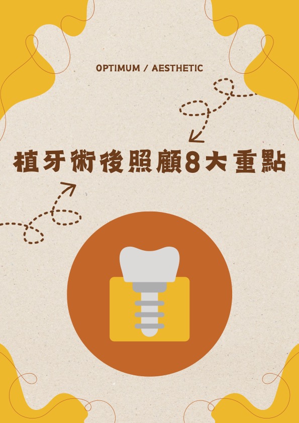 植牙術後照顧 8 大重點