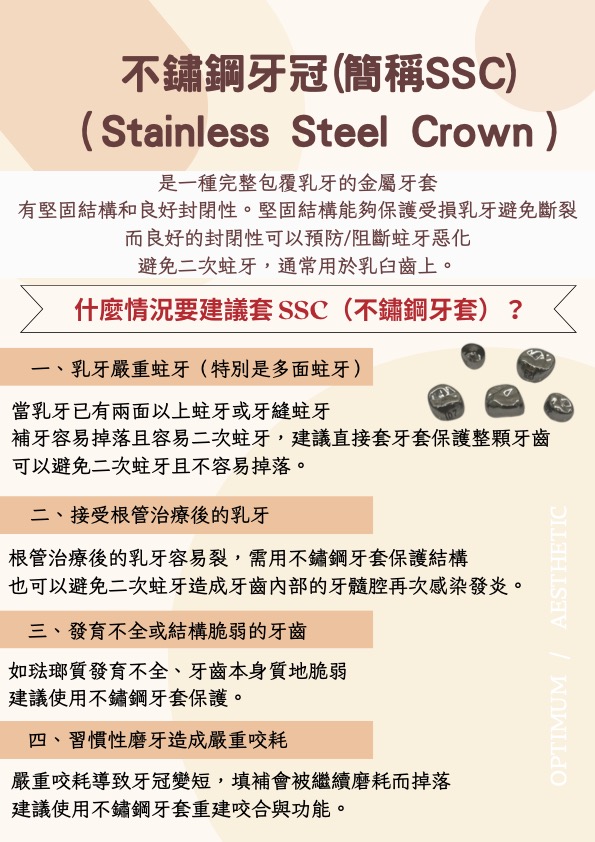不鏽鋼牙冠(簡稱SSC)