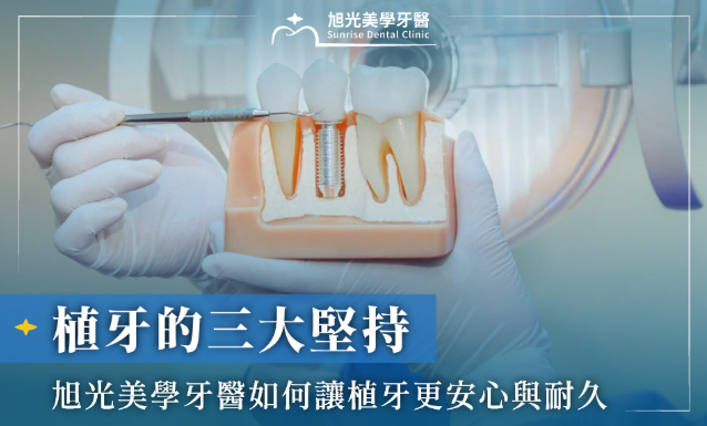 植牙的三大堅持：旭光美學牙醫如何讓植牙更安心與耐久