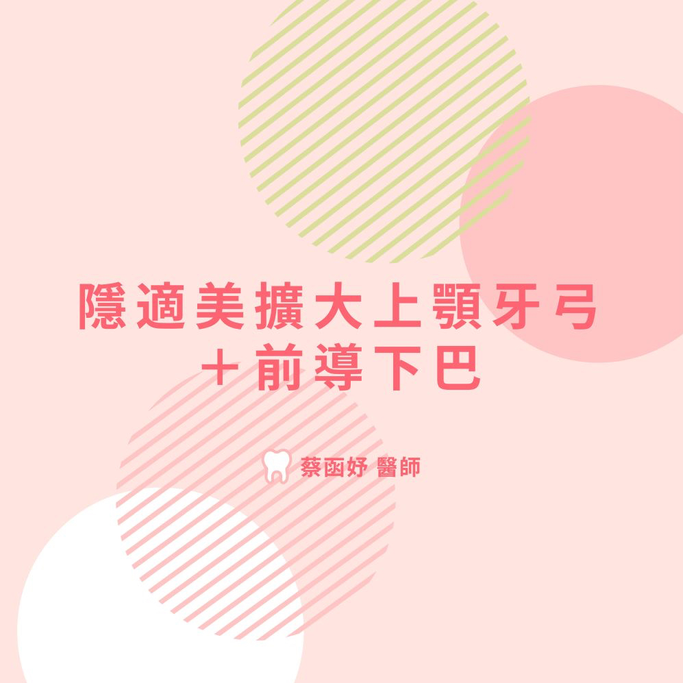 擴大牙弓＋前導下巴