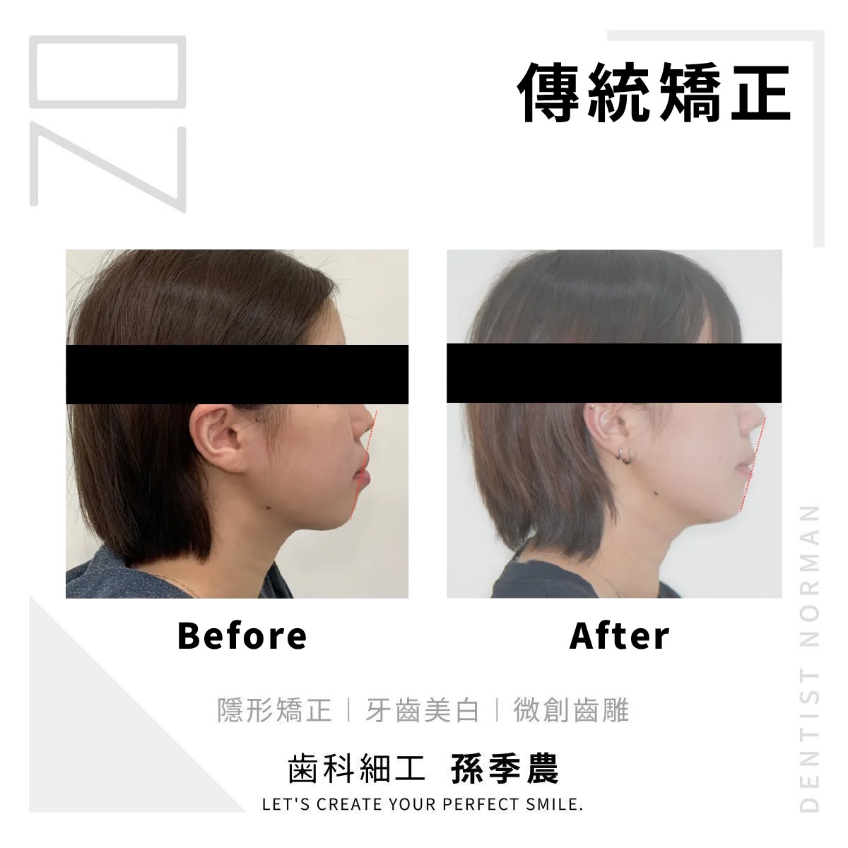 傳統矯正