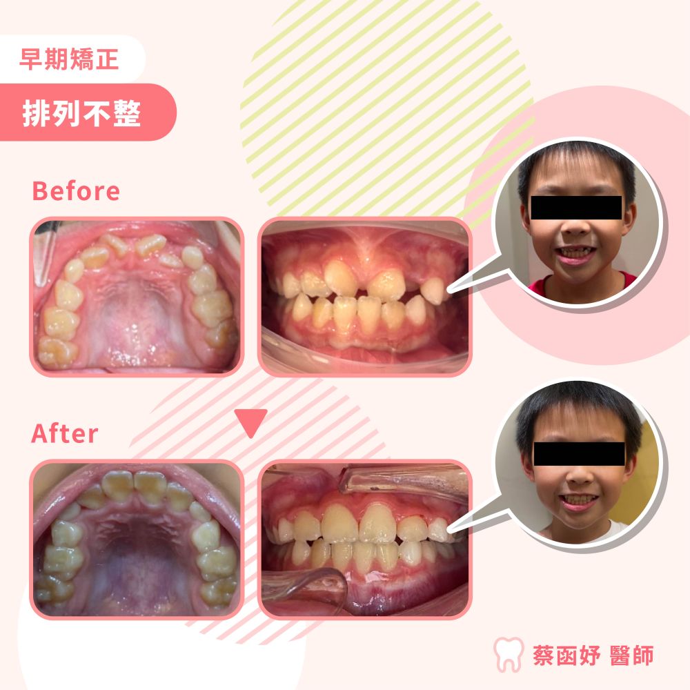 排列不整