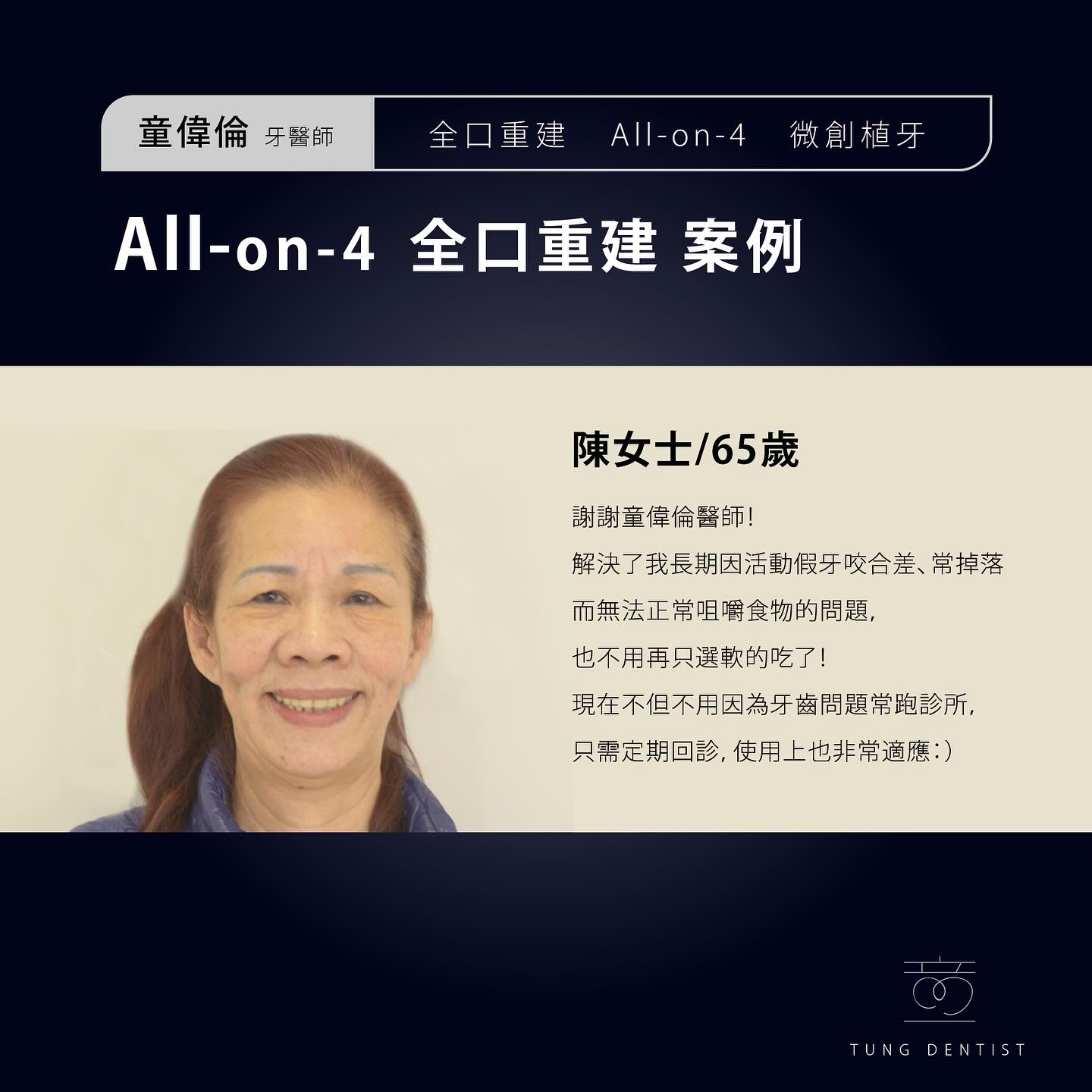 All-on-4 案例