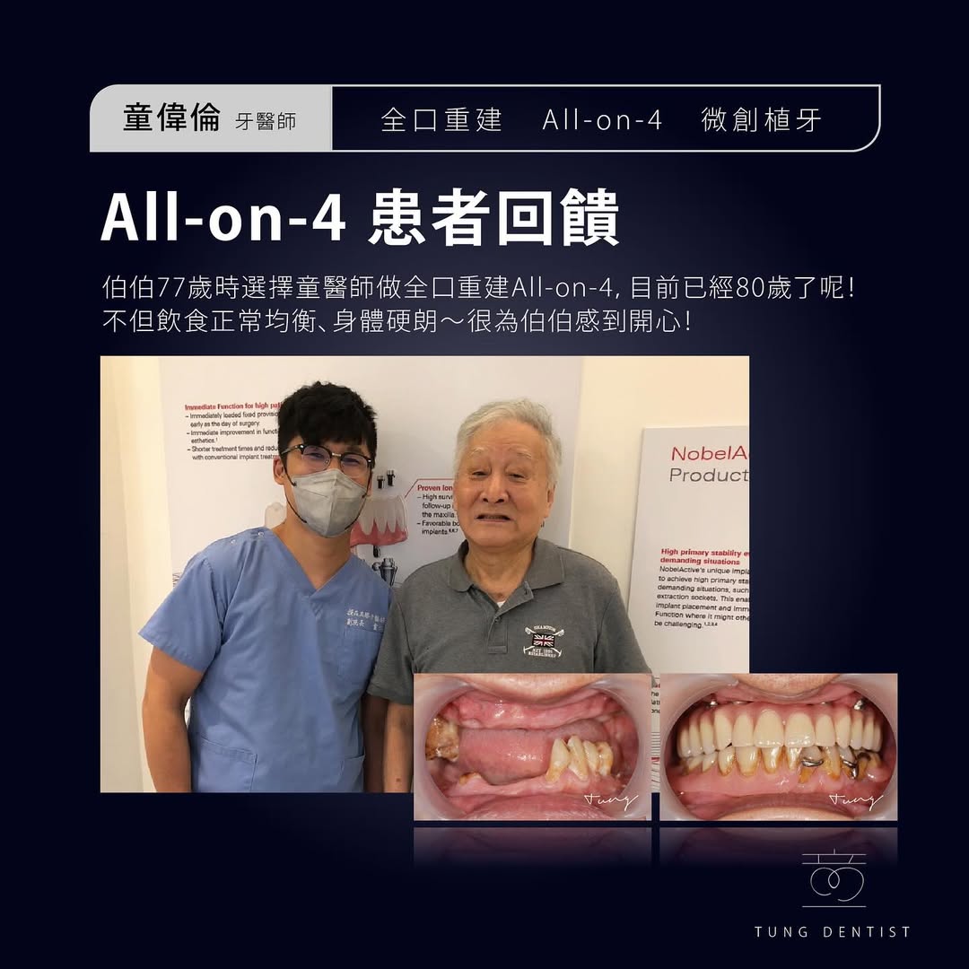 All-on-4 案例 - 鄭伯伯