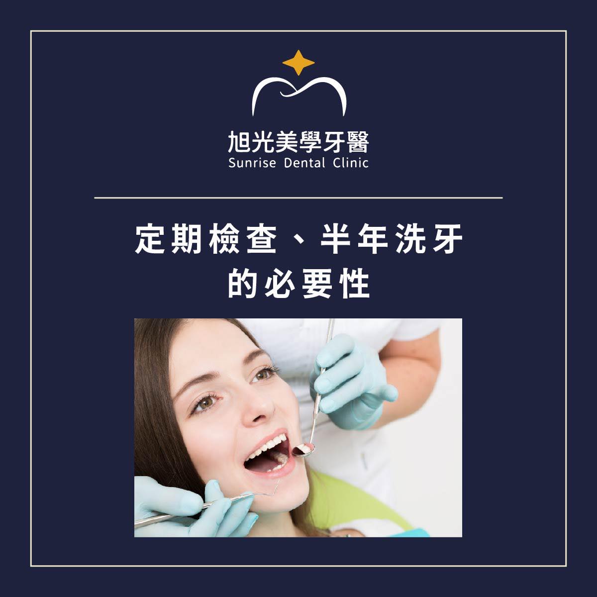洗牙的間隔要多久?為什麼要洗牙?