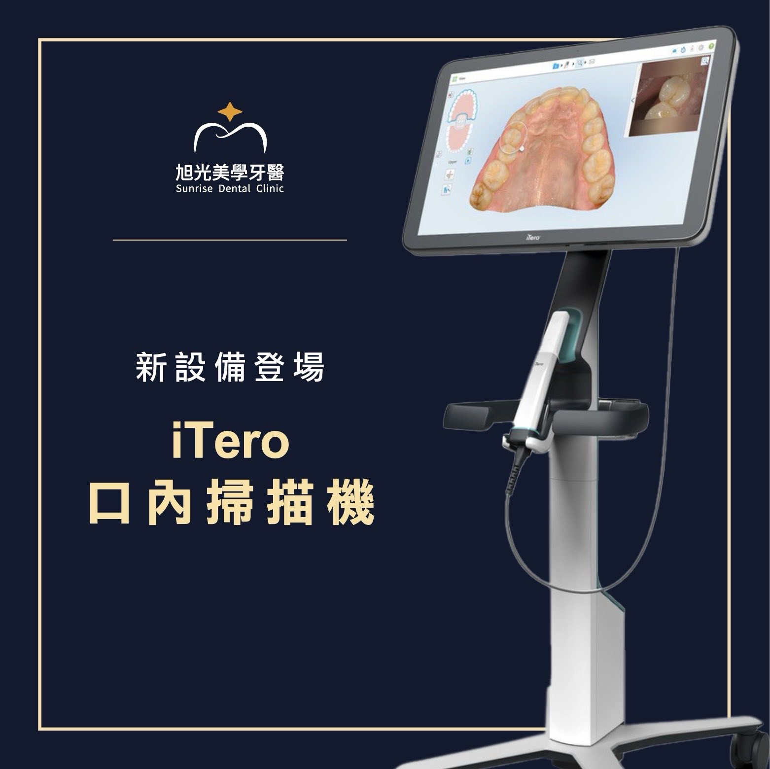 🦷《旭光牙醫》新設備登場|iTero口內掃描機