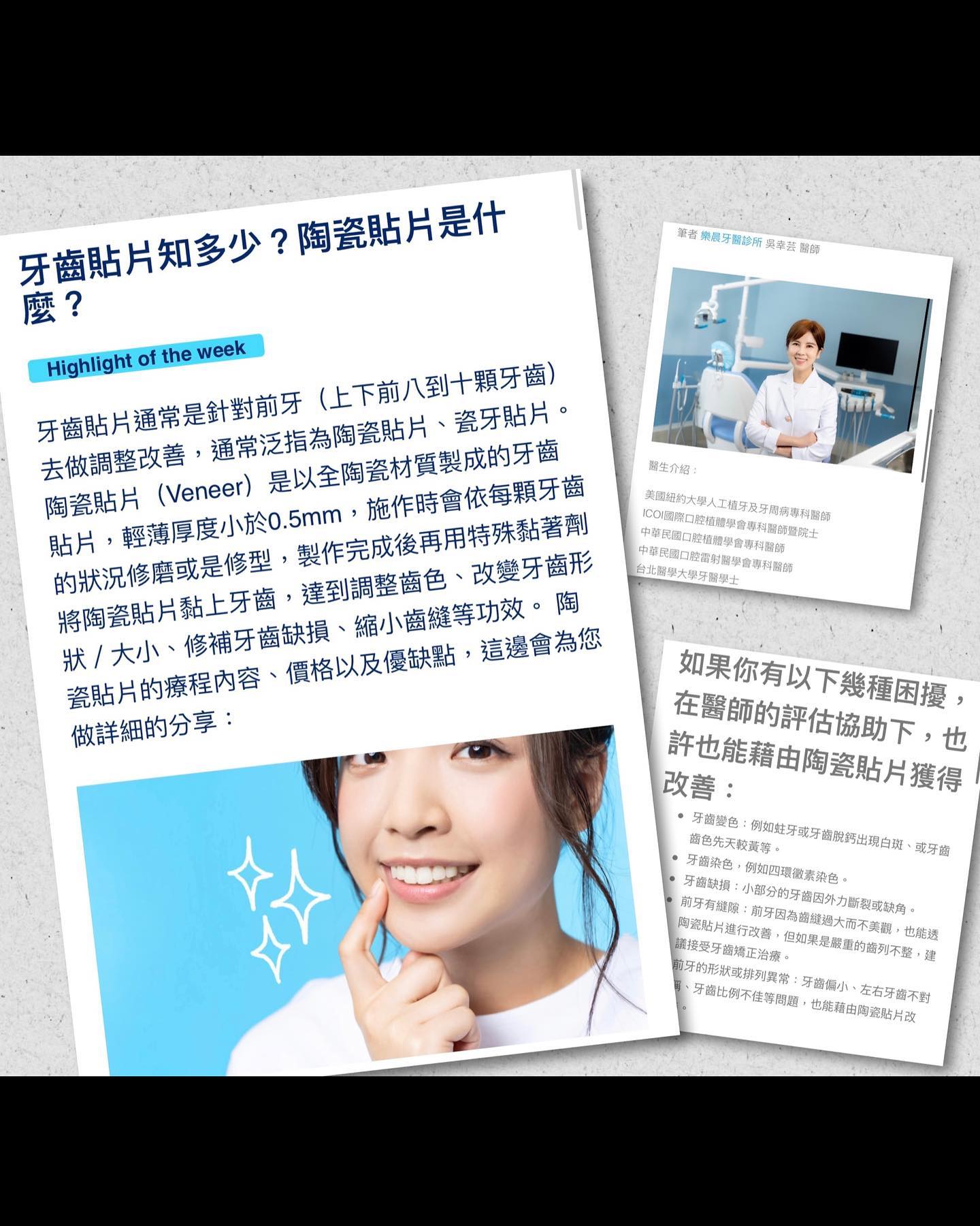 牙齒貼片是什麼？