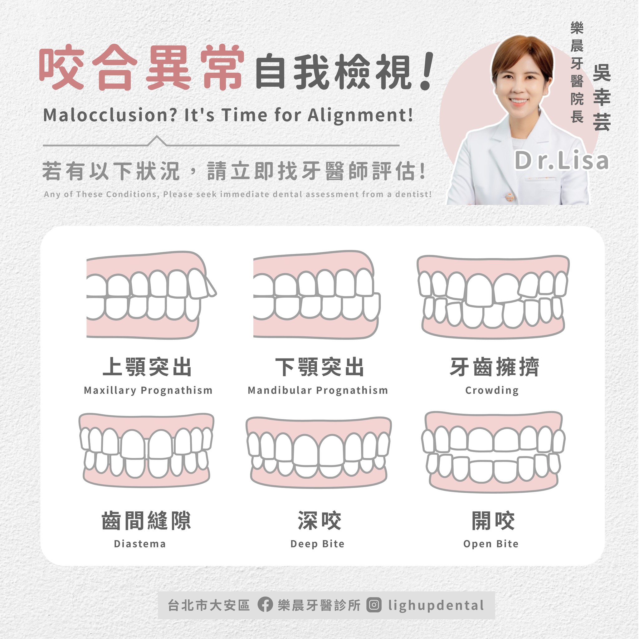 咬合異常自我檢視！