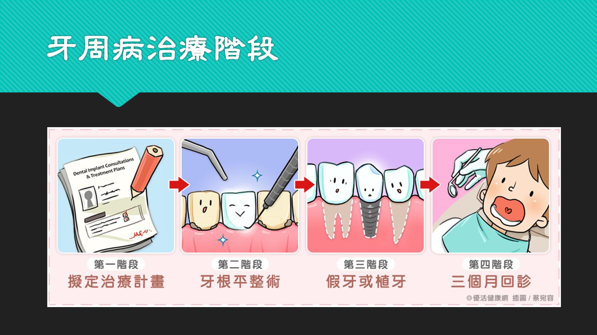牙周病治療階段