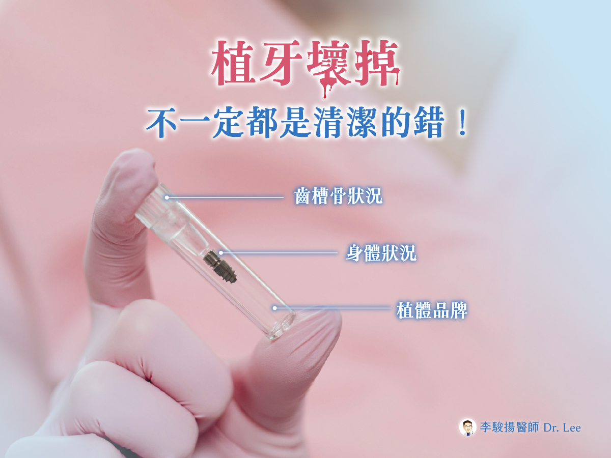 明明認真清潔,植牙卻還是出問題?