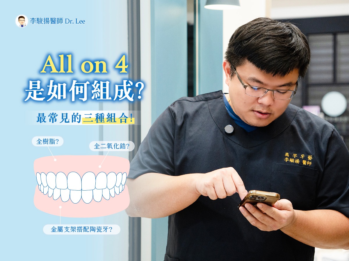 你的 All-on-4 是用什麼做的?