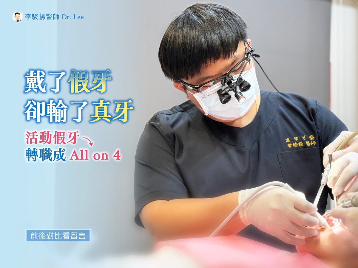 戴了活動假牙,卻輸掉了真牙 …