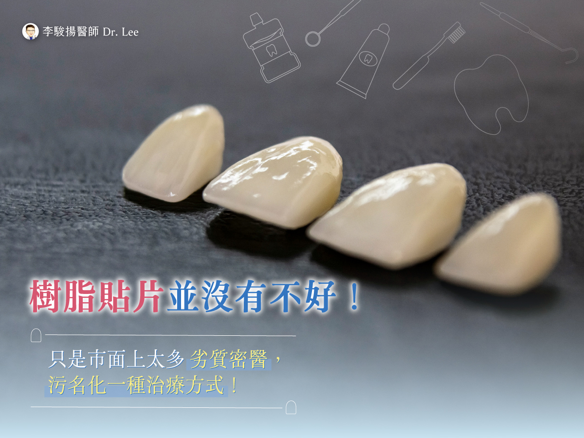 你是不是也誤會樹脂貼片了?