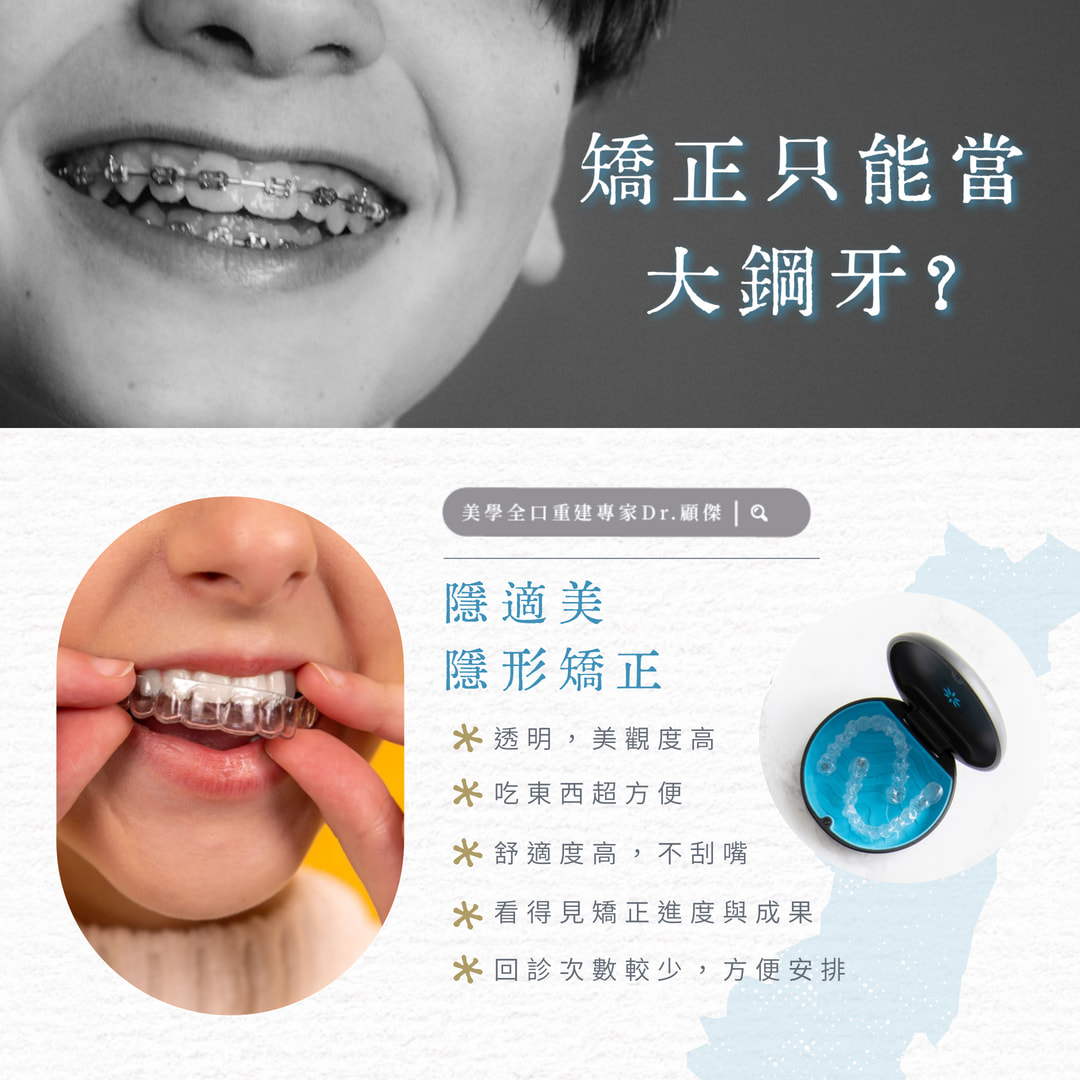 😬 還在以為矯正只能當「大鋼牙」嗎？