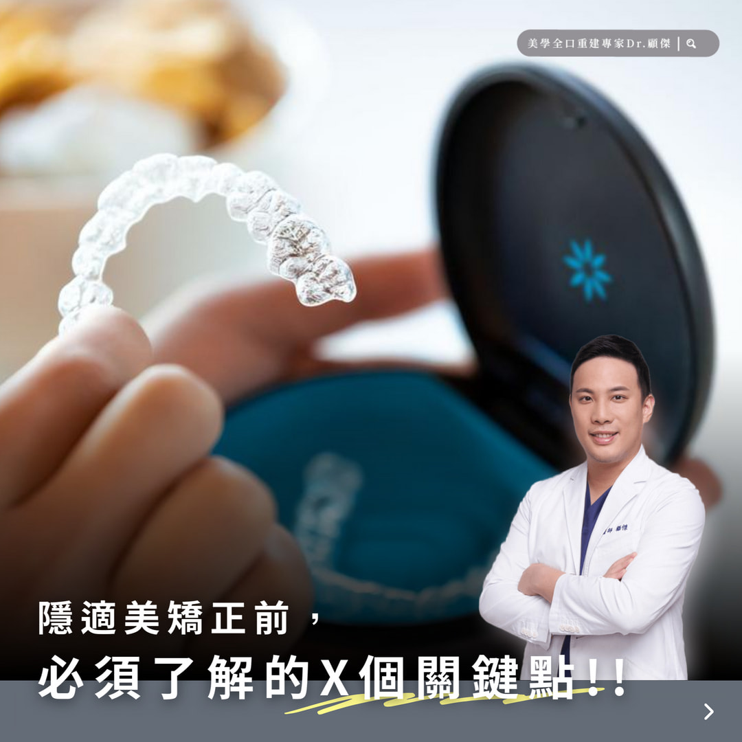 牙齒矯正前必看