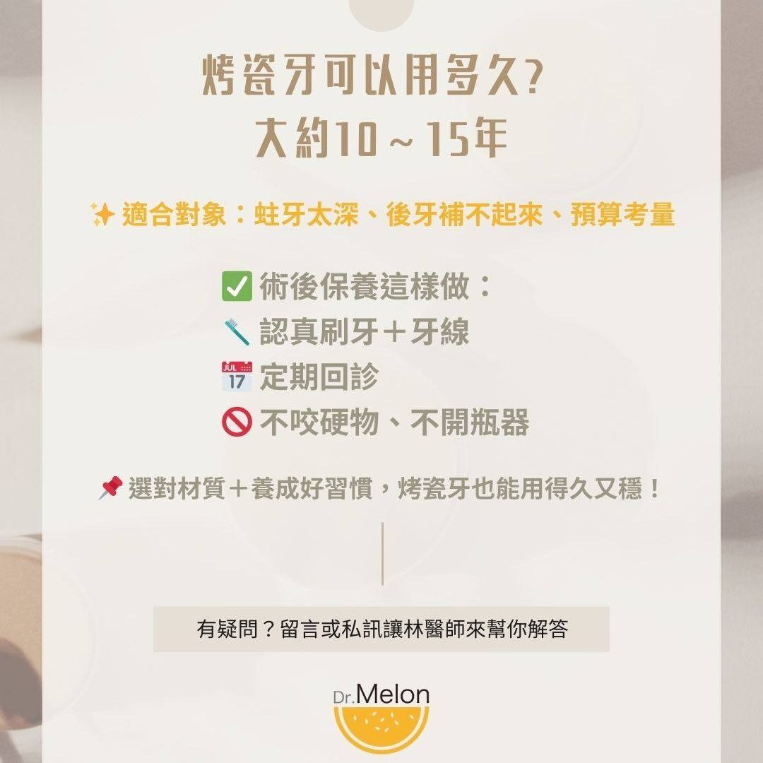 烤瓷牙 Dcard 常見疑惑一次看