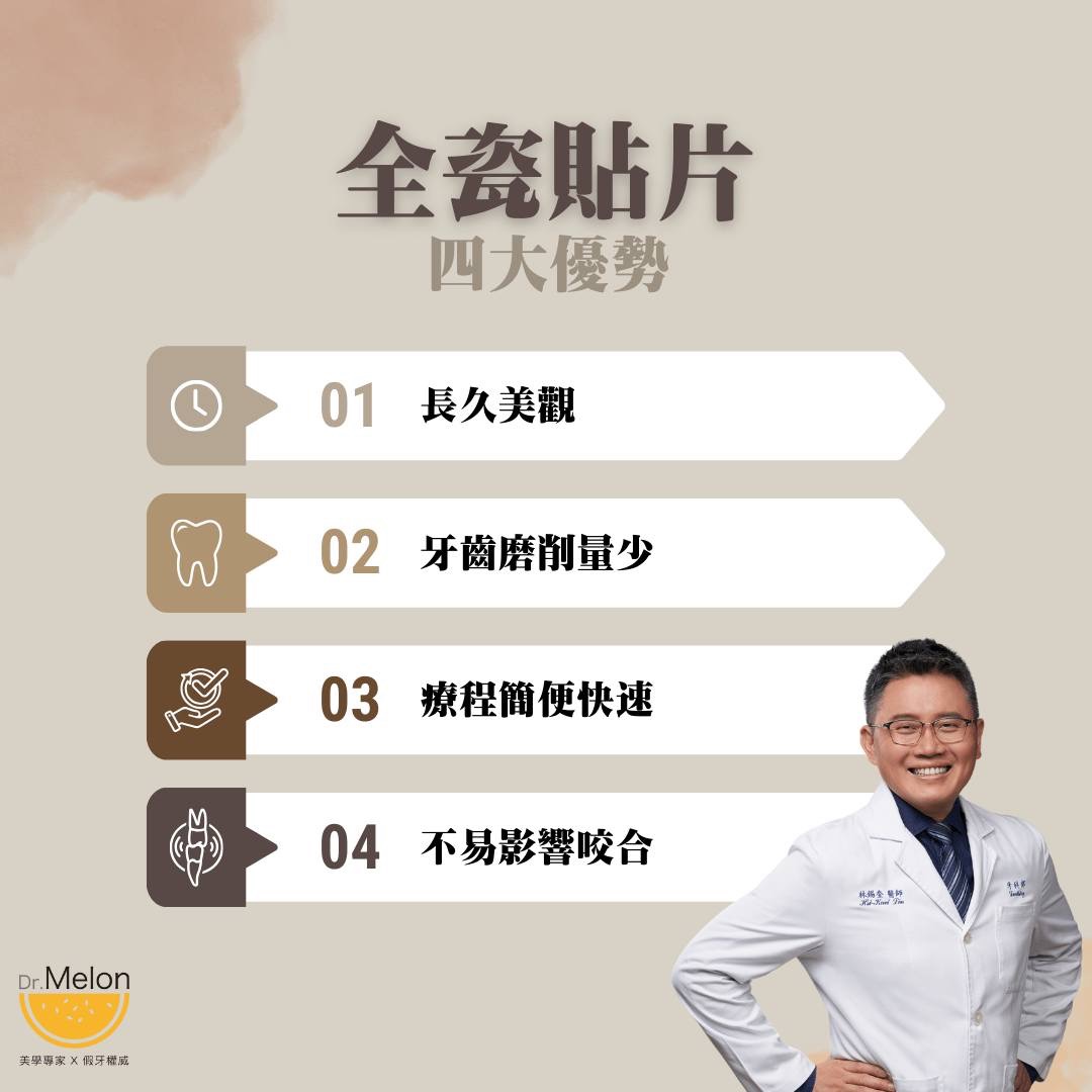 全瓷貼片四大優勢