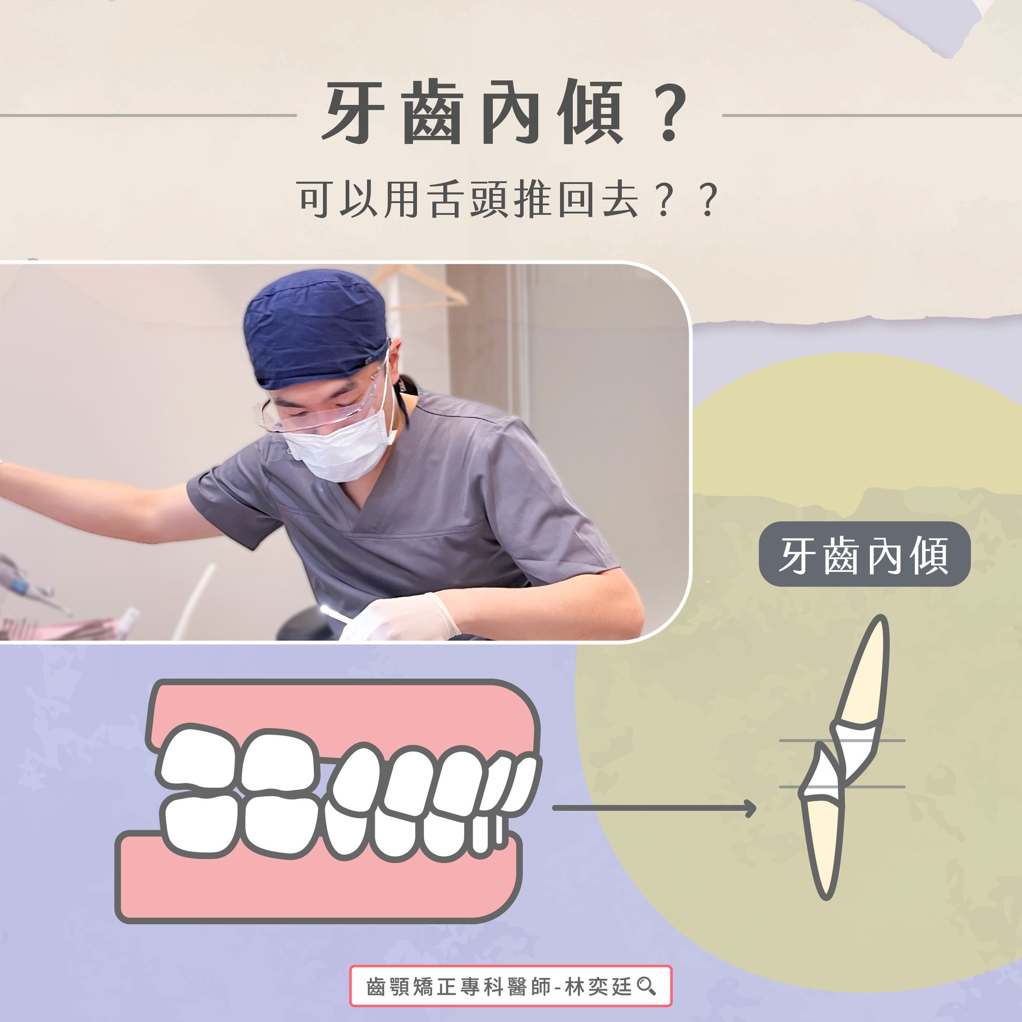 ➤ 牙齒內傾?可以用舌頭推回去??