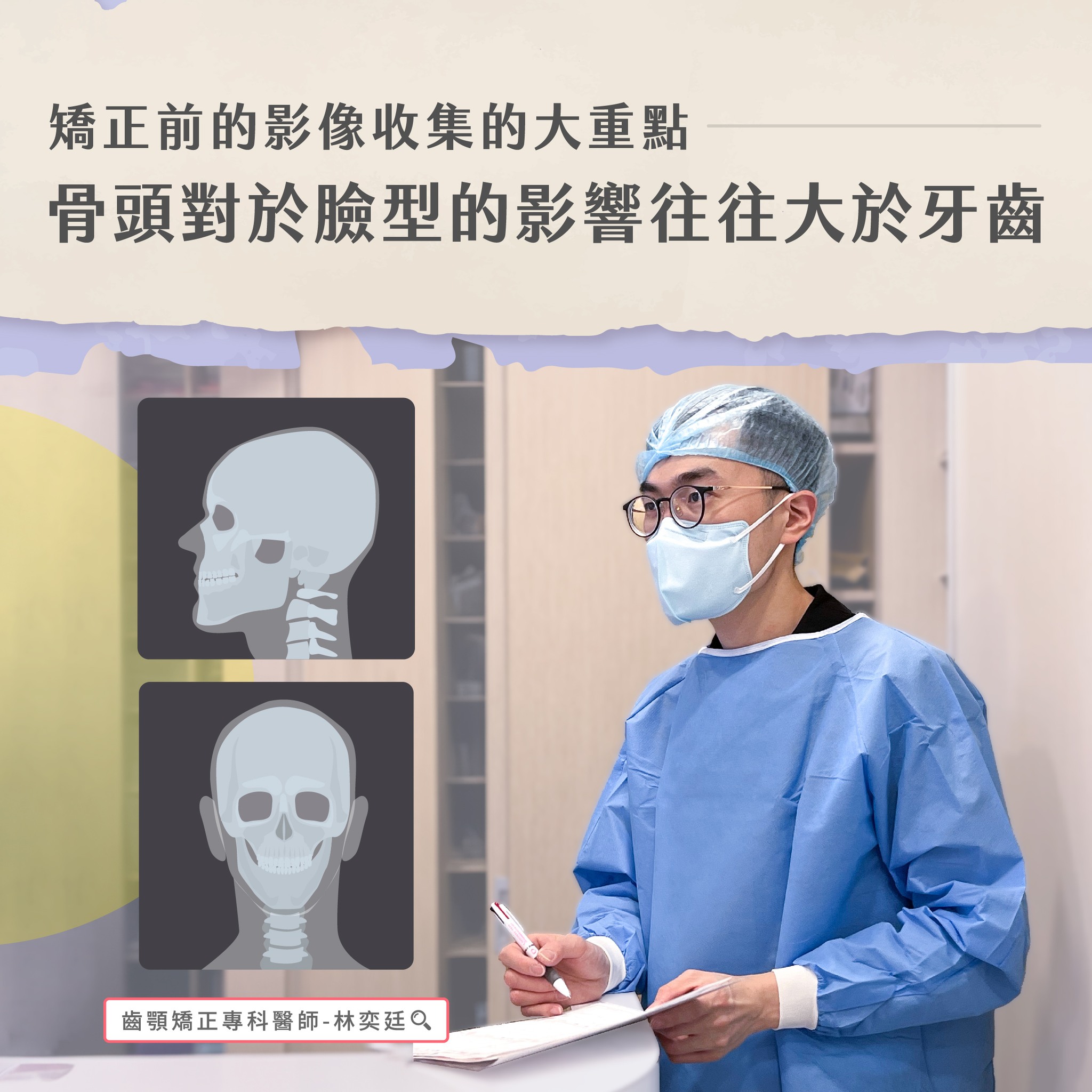 ➤ 矯正前的影像收集的大重點:骨頭對於臉型的影響往往大於牙齒