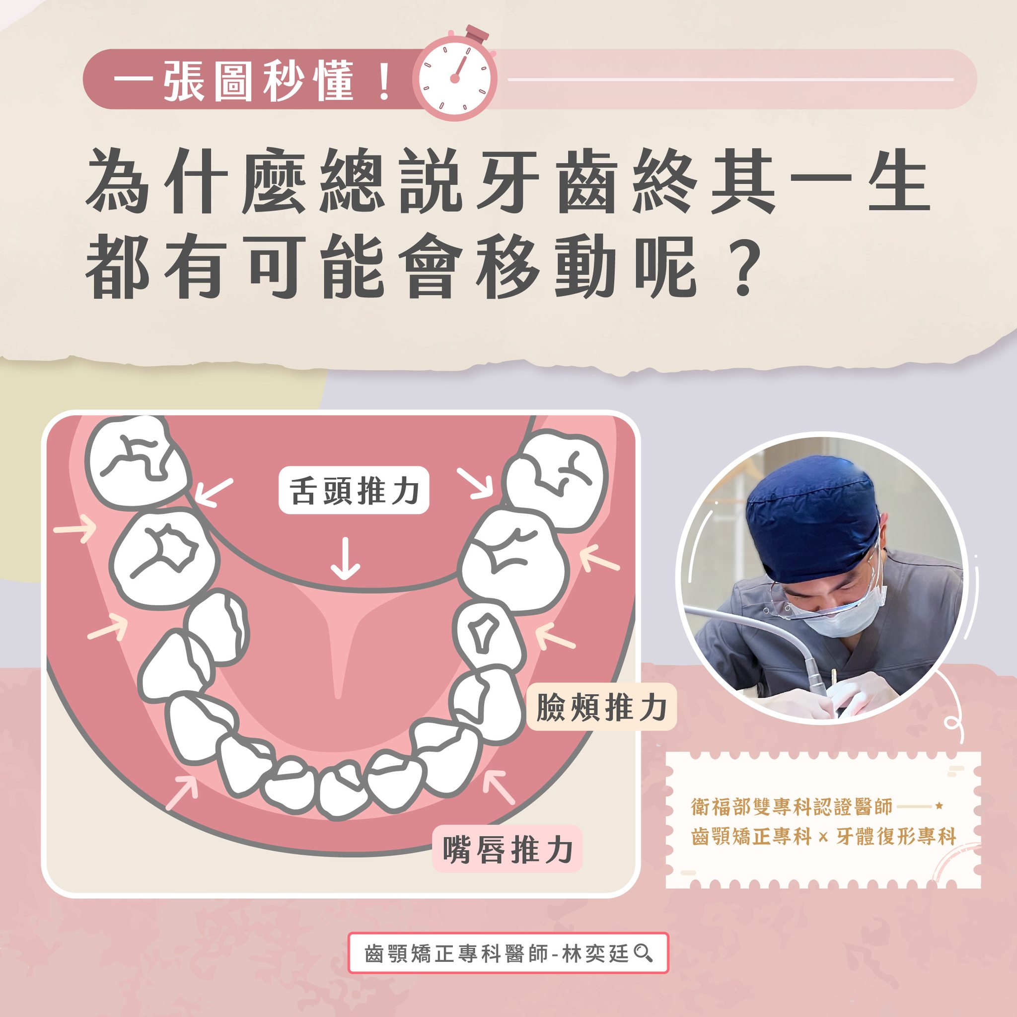 ➤ 為什麼總說牙齒終其一生都有可能會移動呢?