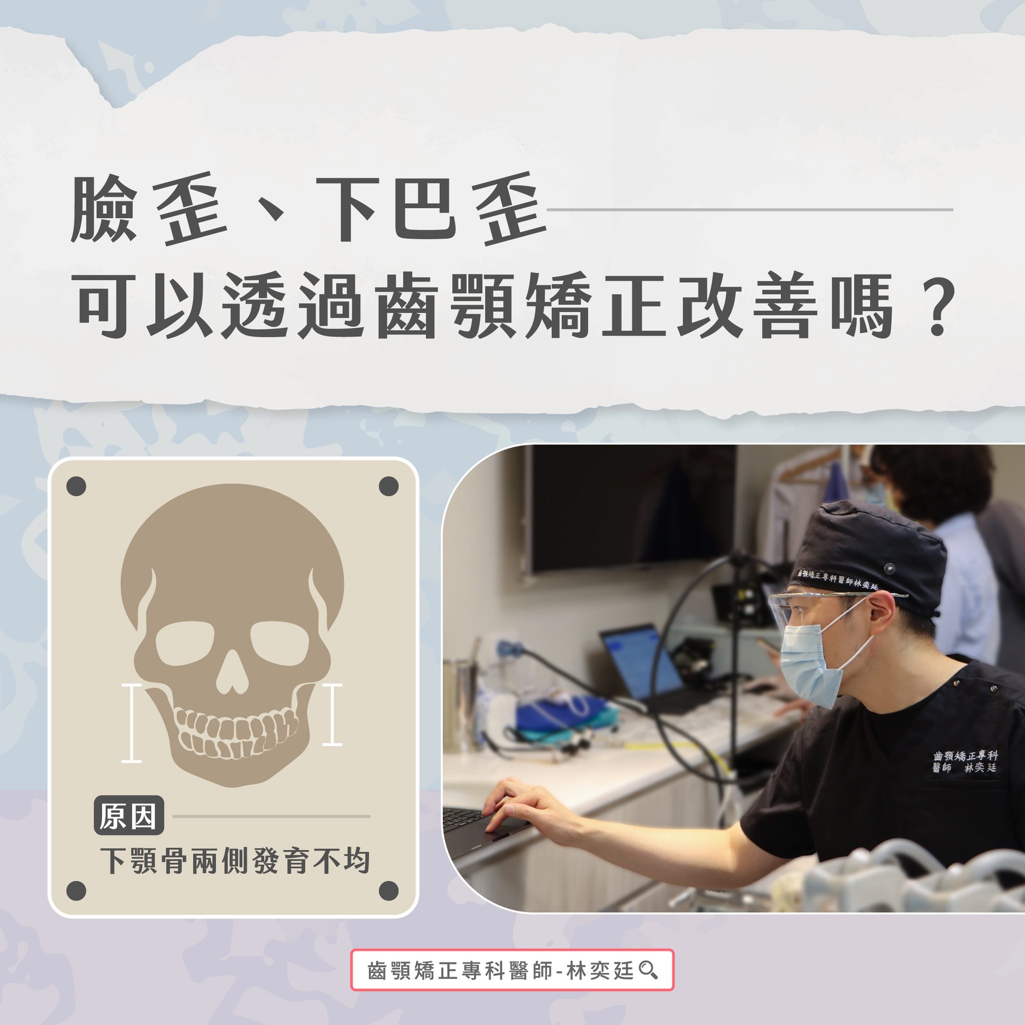 ➤ 臉歪、下巴歪 可以透過齒顎矯正改善嗎?