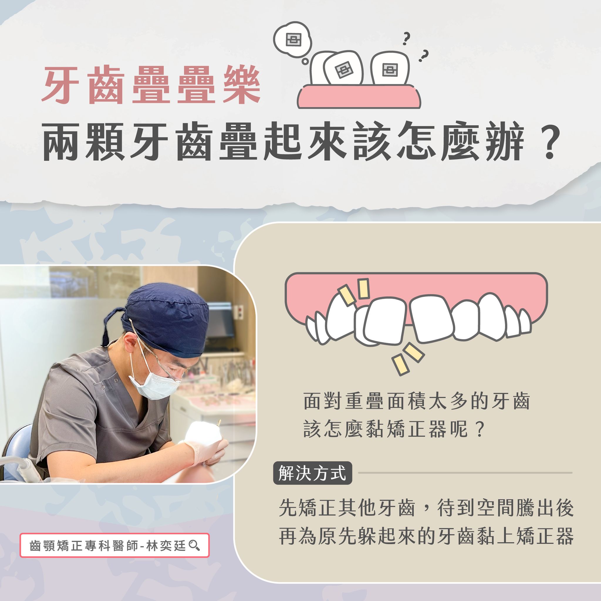 ➤ 牙齒疊疊樂,兩顆牙齒疊起來該怎麼辦?