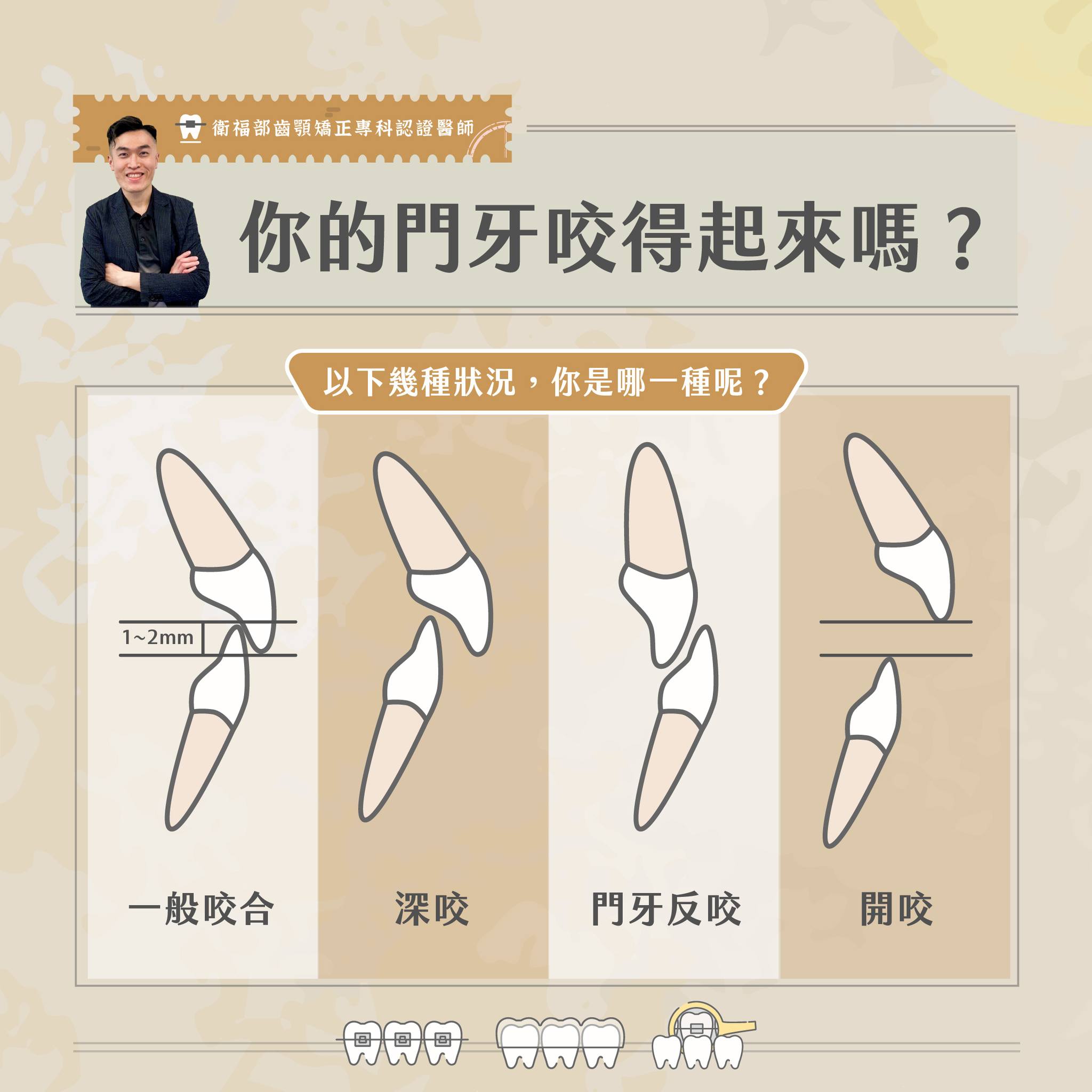 ➤ 你的前牙咬得起來嗎?你的狀況是哪一種呢?
