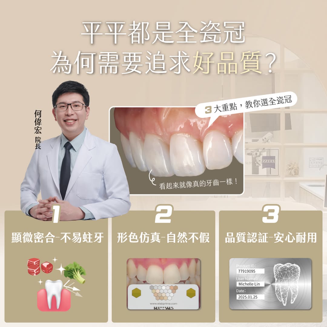 全瓷冠該怎麼選？