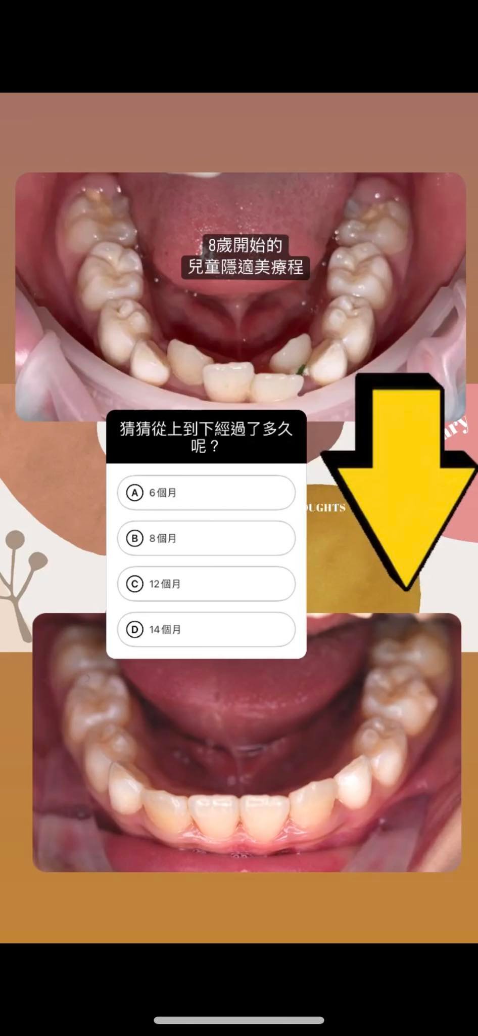 朗朗醫師案例回顧