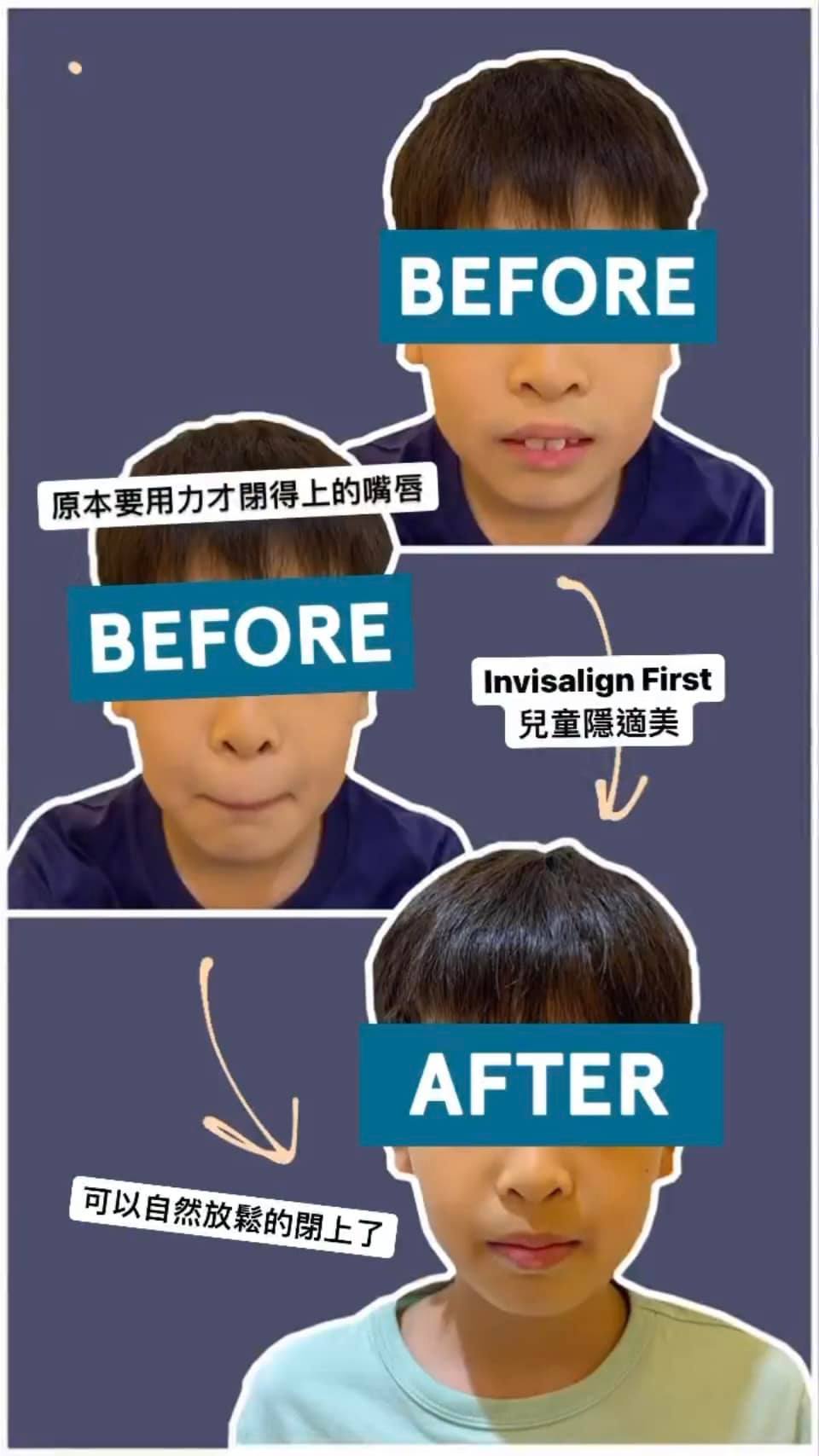 朗朗醫師案例回顧