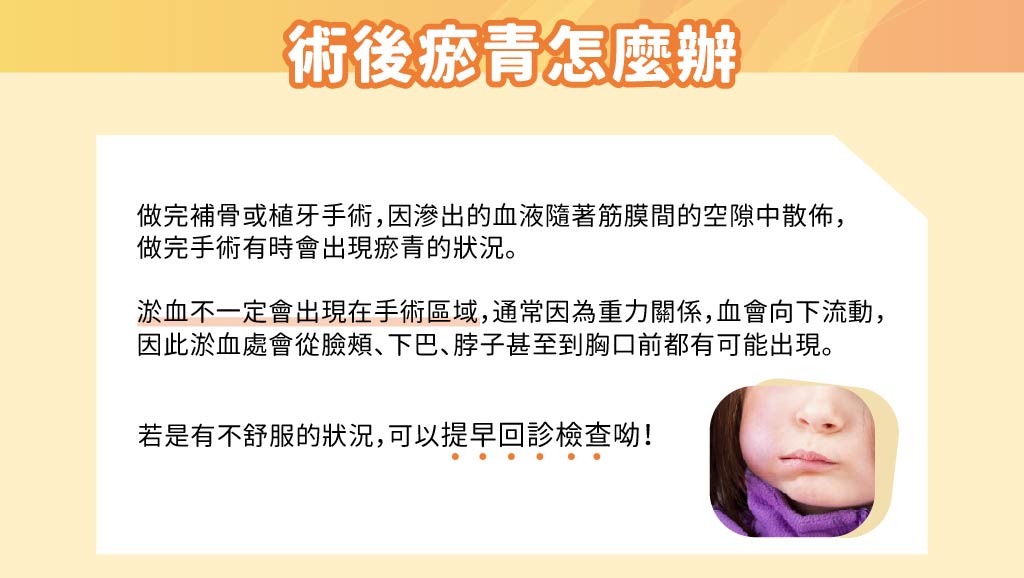 術後瘀青怎麼辦