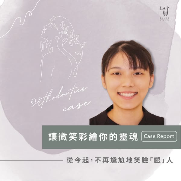 笑臉迎人的妹妹