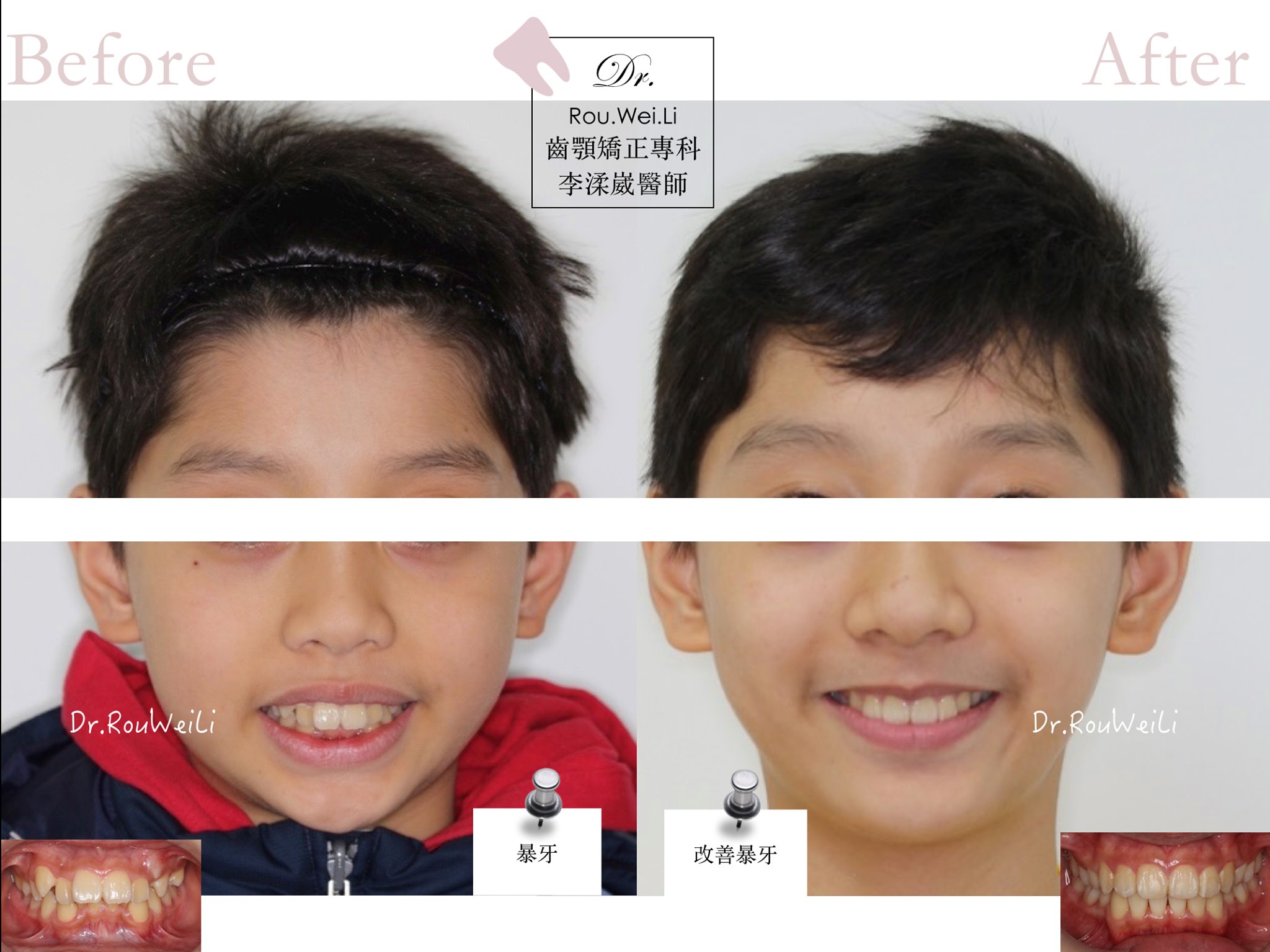 菁英小孩的養成計畫