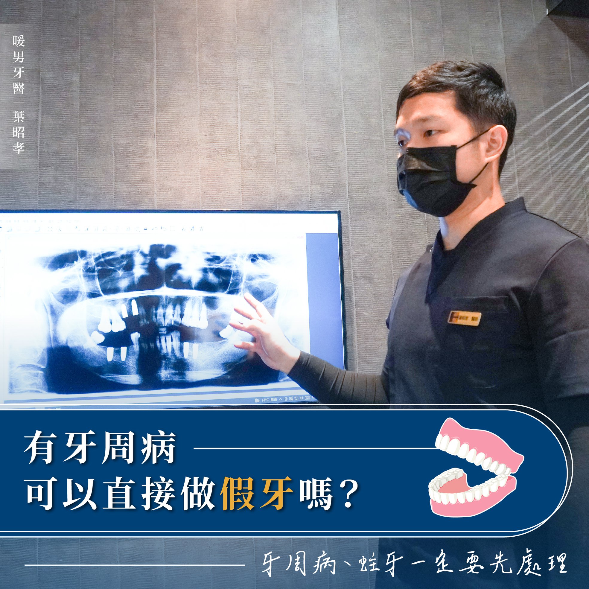有牙周病可以直接做假牙嗎？