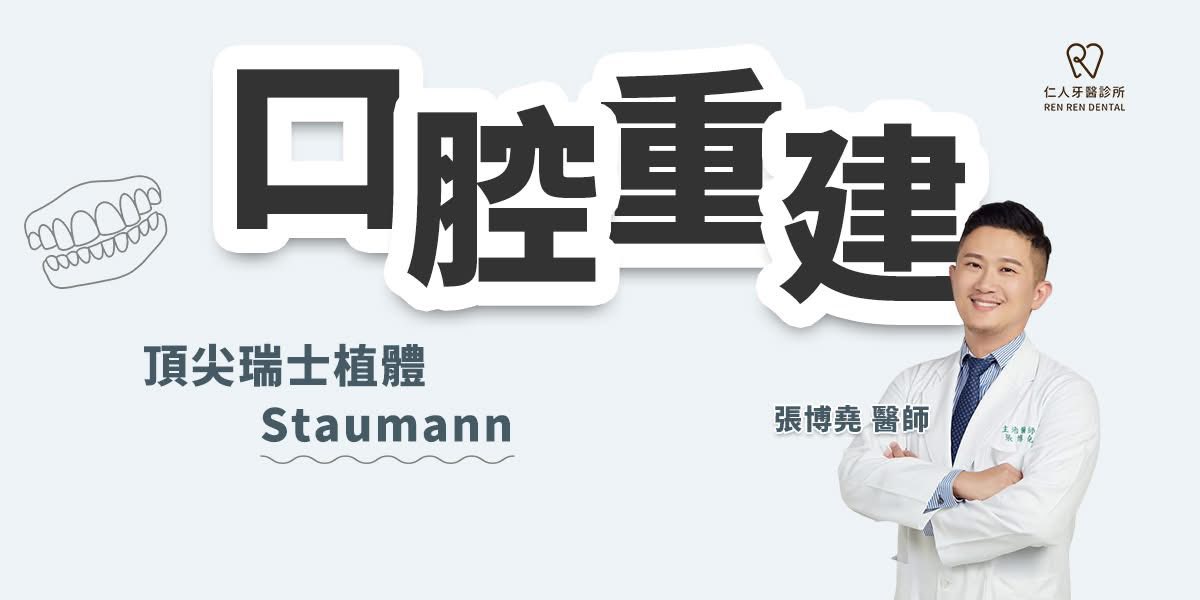 缺牙困擾?口腔重建首選💡