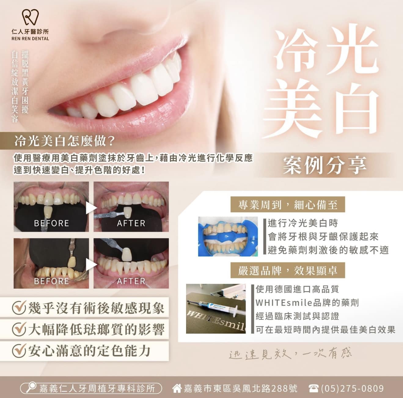 整齊的牙齒還不夠!!#秀出妳的亮白美齒吧😄